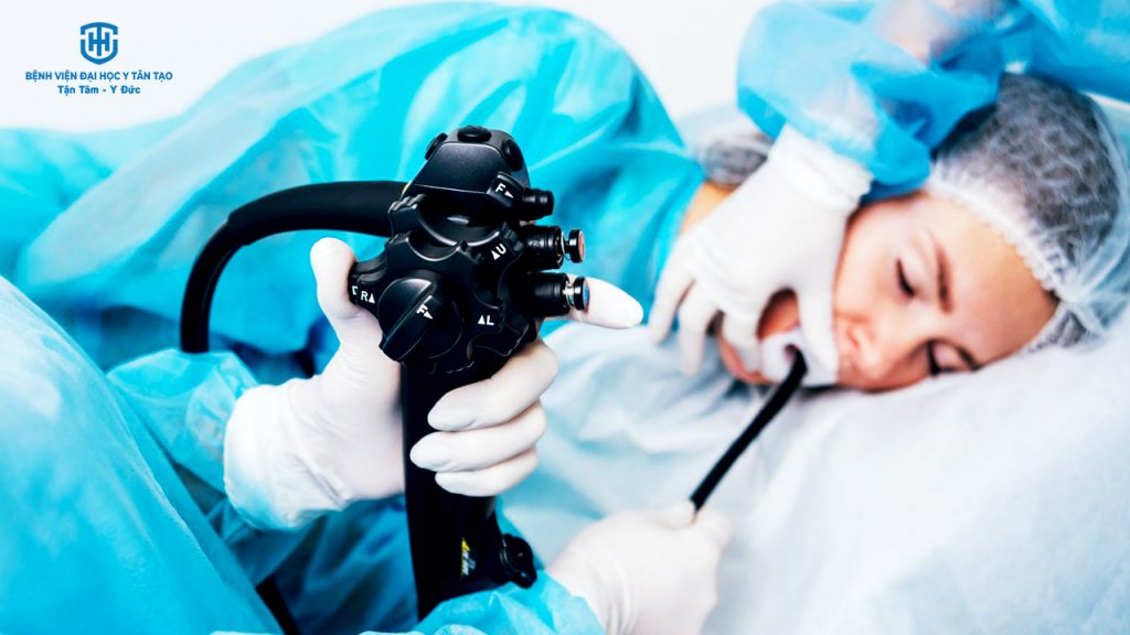 nội soi tiêu hóa gây mê - nội soi tiêu hóa gây mê là gì