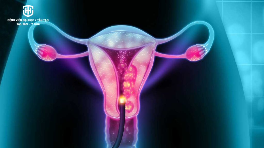 kinh nghiệm đi khám tầm soát ung thư - ung thư cổ tử cung