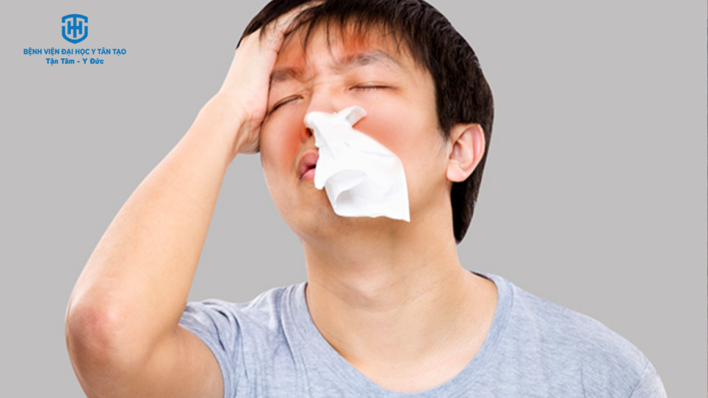 viêm mũi xoang dị ứng là gì