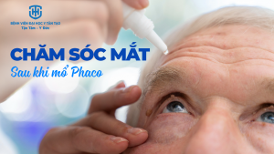 chăm sóc mắt sau mổ phaco