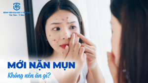 mới nặn mụn không nên ăn gì