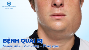 bệnh quai bị - nguyên nhân triệu chứng