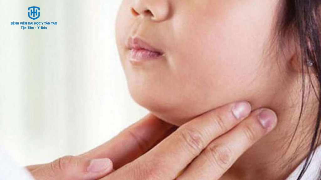 bệnh quai bị là gì