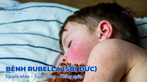bệnh rubella - nguyên nhân, triệu chứng, phòng ngừa