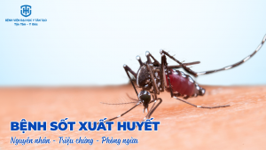 bệnh sốt xuất huyết