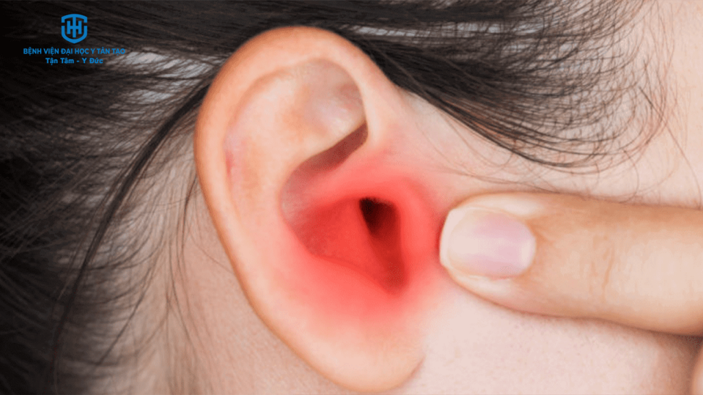 viêm tai giữa là gì