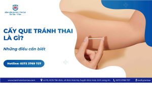 cấy que tránh thai